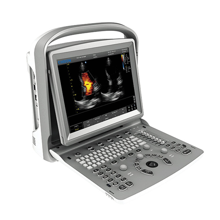 Ecografi Ecocolordoppler