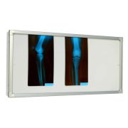 Negativoscopio 120 x 42 - Orizzontale con 2 lampade 